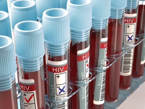 Анализ крови на ВИЧ
