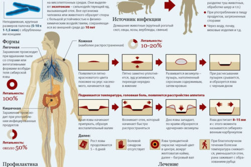 Формы сибирской язвы и их симптомы