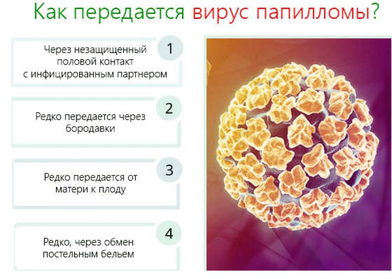 Вирус папилломы человека лечение — proinfekcii.ru