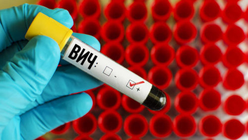 анализ крови на ВИЧ-инфекцию