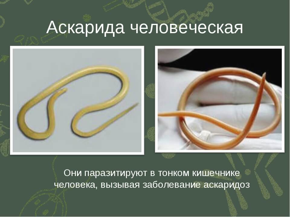 Почему круглых червей. Круглые черви паразиты Острица. Размер и форма круглых гельминтов аскариды. Человеческая аскарида и Острица. Тип круглые черви аскарида.