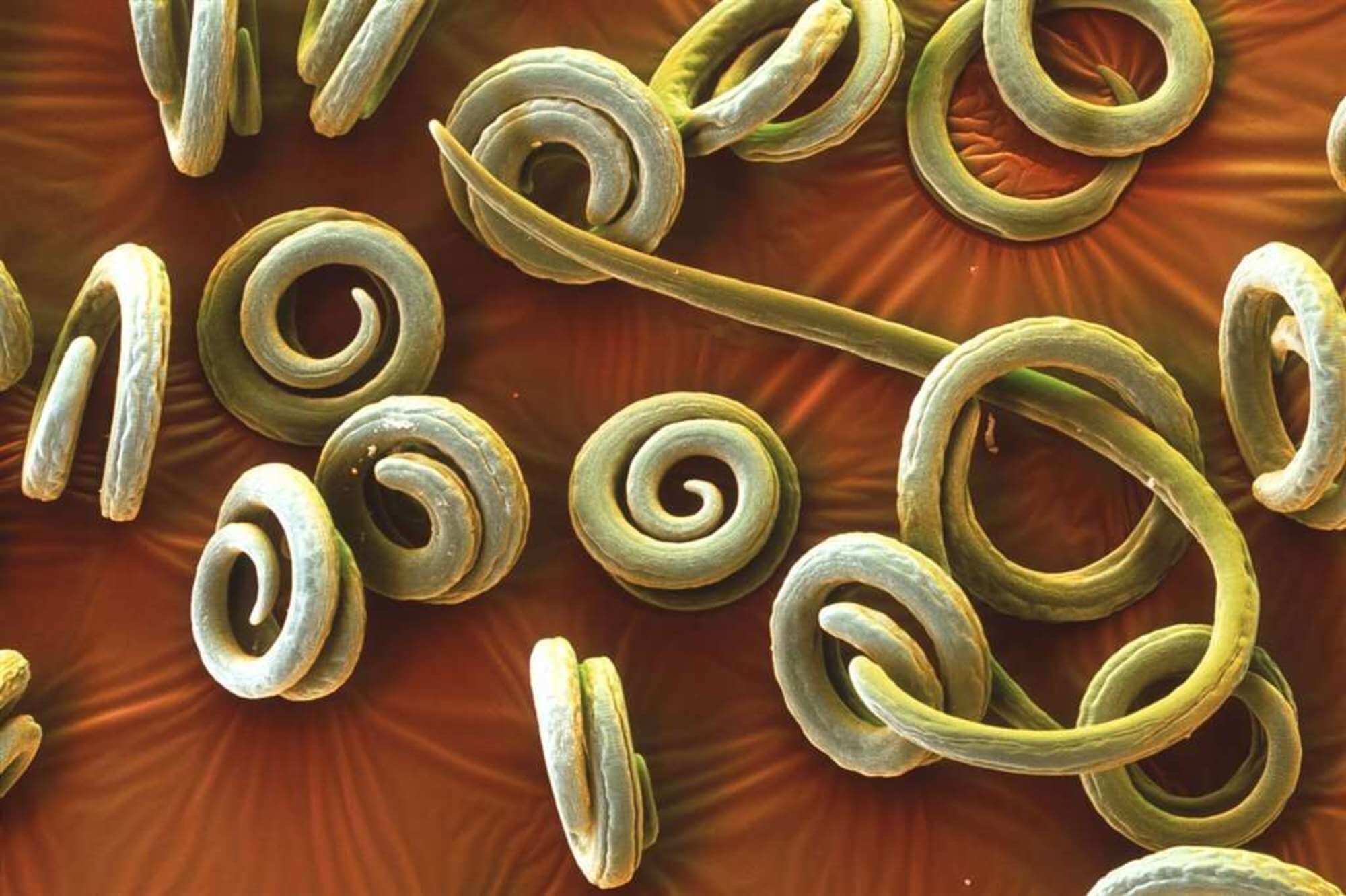 Биогельминтозы. Круглые черви аскарида трихинелла. Глистные инвазии трихинеллез.