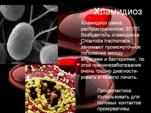 Бактерии хламидий