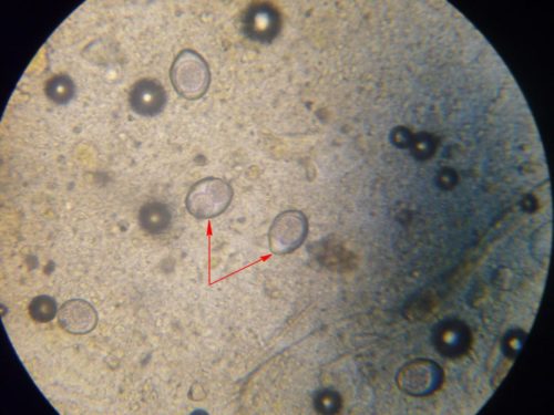 яйца глистов под микроскопом