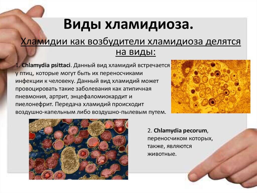 Болезни также является. Инфекция хламидия трахоматис. Хламидийные инфекции инфекционные болезни. Типы бактерий хламидии.